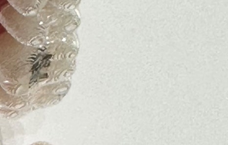 연희임플란트 디지털 네비게이션과 3D 기술로 안전하고 정밀하게 관련 이미지 17