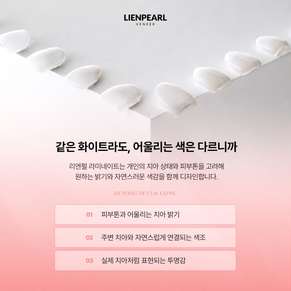 라미네이트 치아 미백, 내 얼굴에 어울리는 밝기를 찾는 법! 관련 이미지 4
