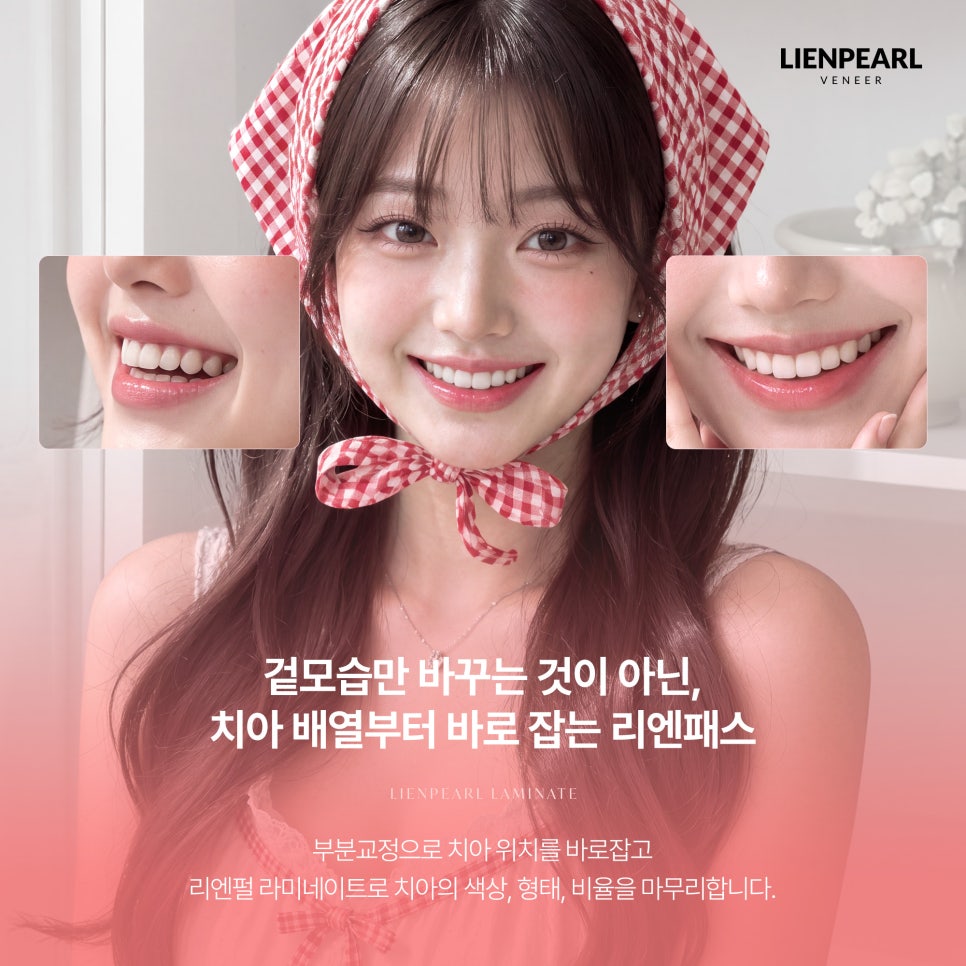 치아 배열부터 바로잡는 리엔패스 라미네이트 관련 이미지 2