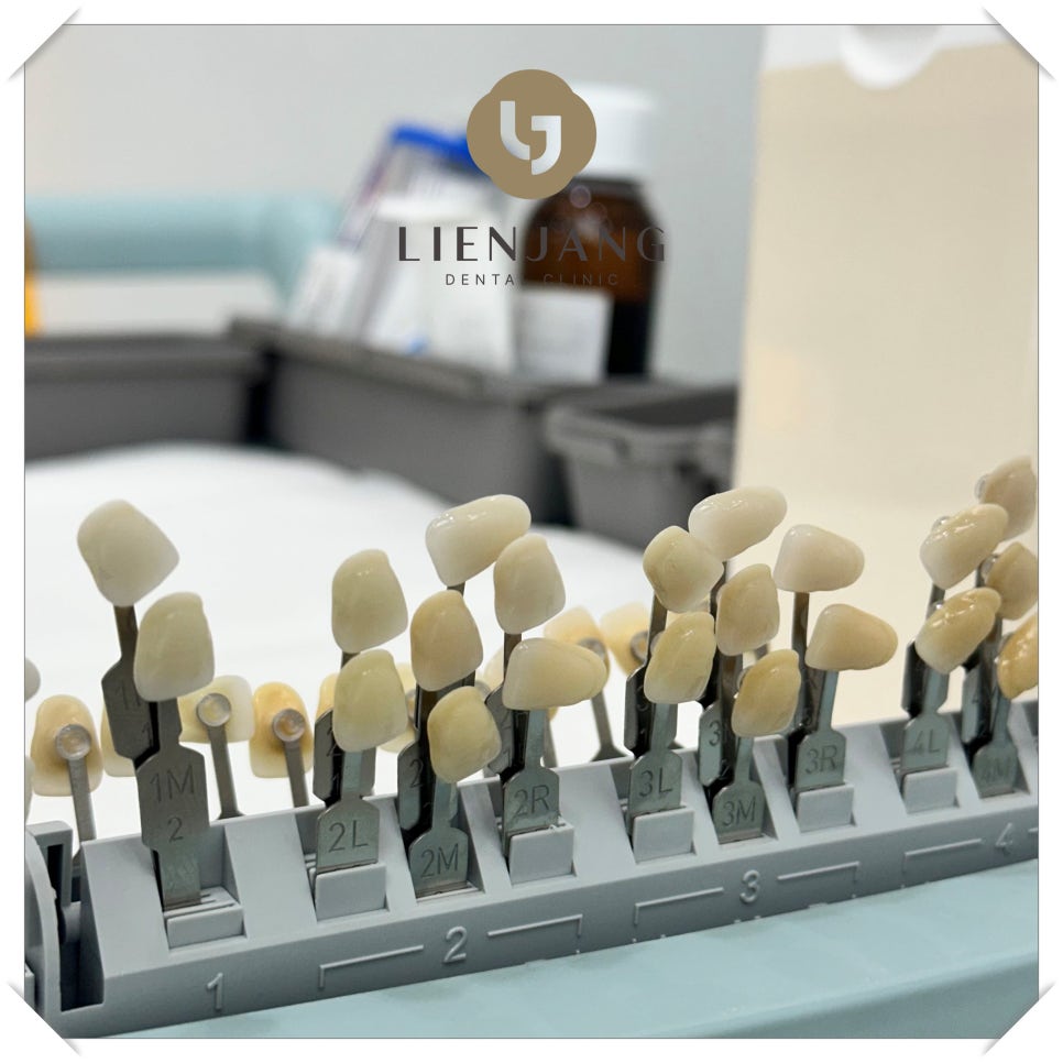 남영동임플란트 비교하기 어려웠다면 관련 이미지 3