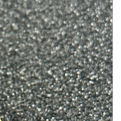 갑자기이빨아플때 원인과 치료 과정 관련 이미지 8