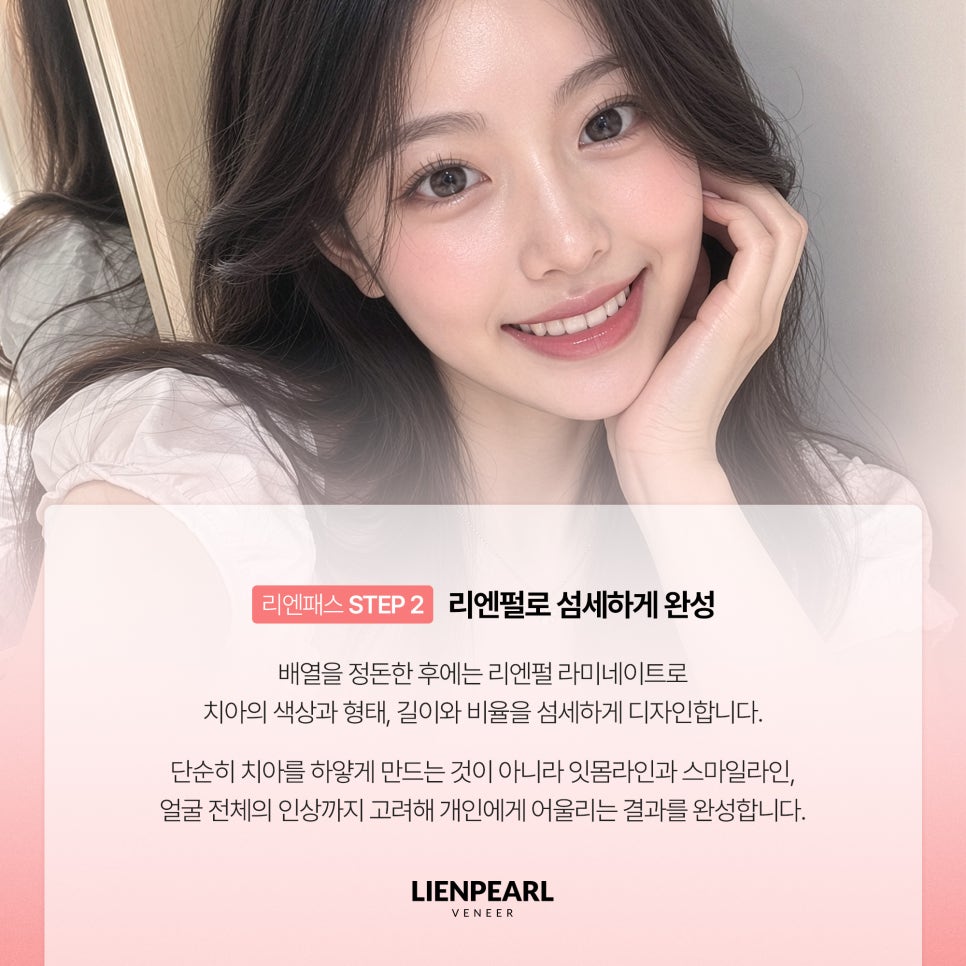 앞니 배열이 고민이라면? 치아교정 라미네이트 리엔패스! 관련 이미지 5