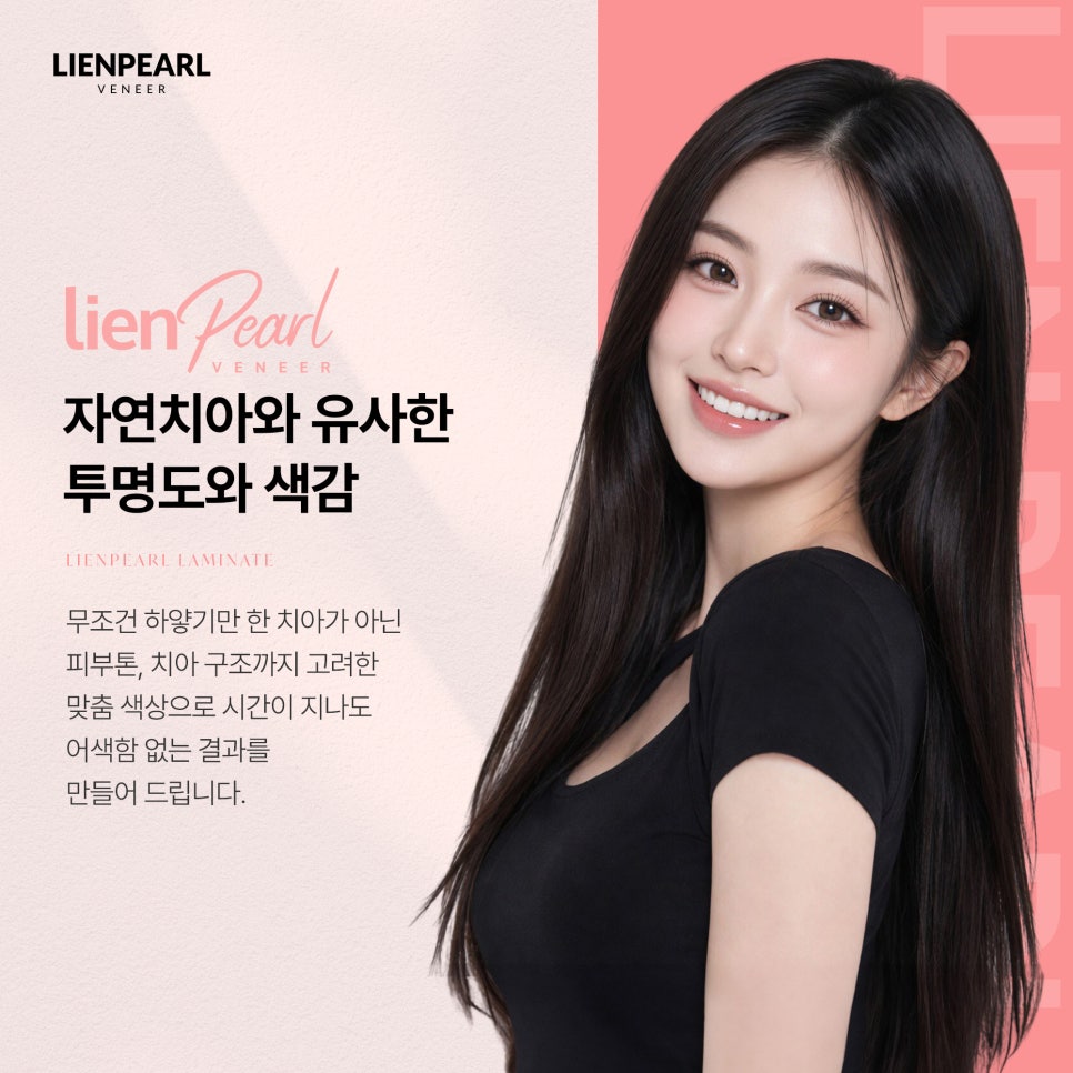 라미네이트 치과 알아볼 때 필수 체크사항은? 관련 이미지 6