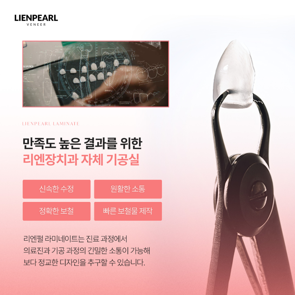 라미네이트 치아 삭제가 걱정된다면, 먼저 확인해야 할 것! 관련 이미지 5