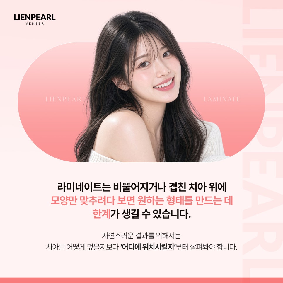 앞니 배열이 고민이라면? 치아교정 라미네이트 리엔패스! 관련 이미지 2