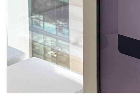 효창동임플란트 뼈 이식까지 생각한다면 관련 이미지 10