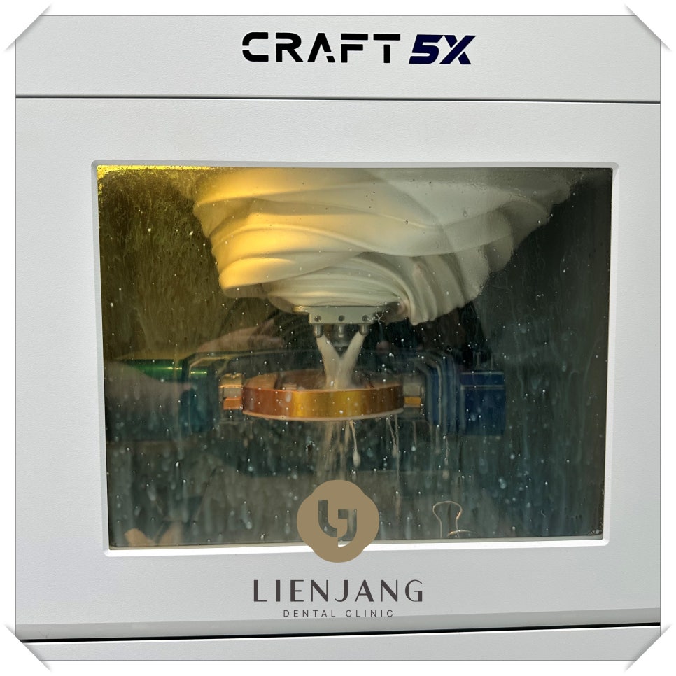 중림동임플란트 쾌적한 식생활을 위해 관련 이미지 3