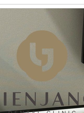 장충동임플란트 주위염 예방하고 건강하게 관련 이미지 14