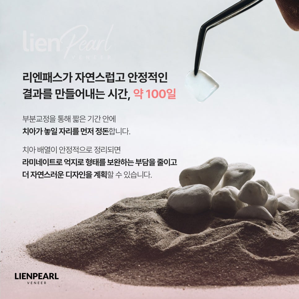 앞니 배열이 고민이라면? 치아교정 라미네이트 리엔패스! 관련 이미지 6