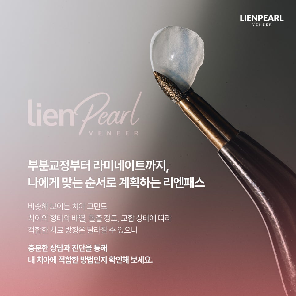 라미네이트 시술 과정은 어떻게 진행될까? 리엔패스로 확인하세요! 관련 이미지 7