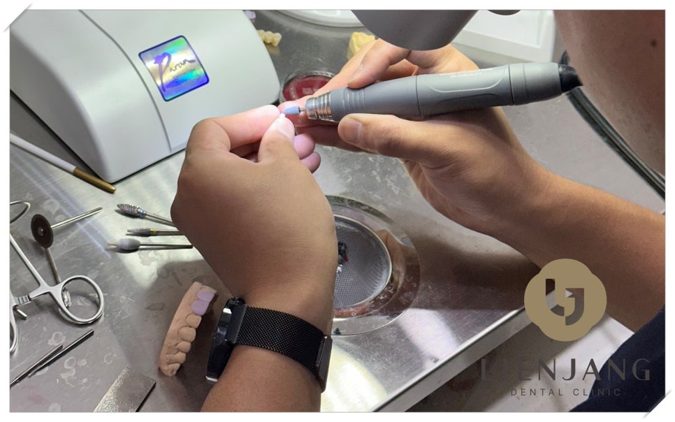 한강로동임플란트 앞니부터 어금니까지 꼼꼼하게 관련 이미지 3