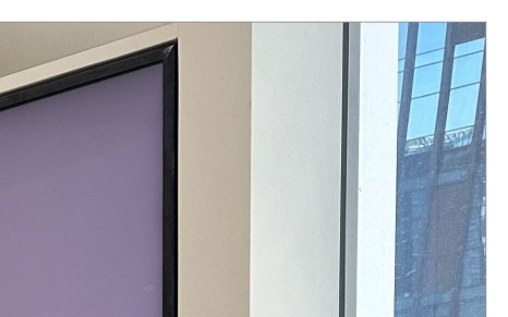 청파동임플란트 선택 고민된다면 관련 이미지 6