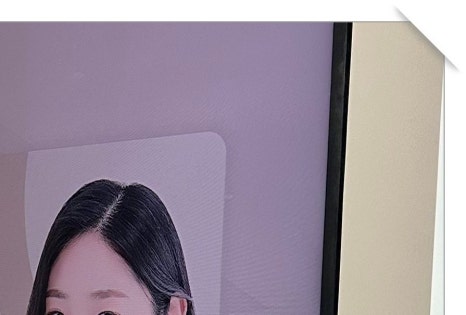 마장동임플란트 편안한 회복을 위해 관련 이미지 6