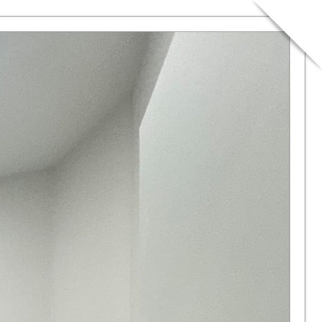 구로동라미네이트 아름다운 미소를 위한 선택 관련 이미지 24