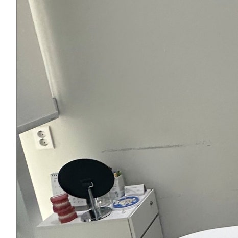 신논현치아미백 누런니 스트레스라면 관련 이미지 6