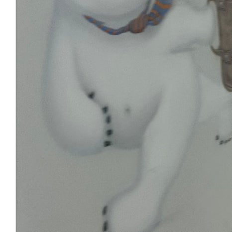 용답동임플란트 뼈 이식까지 고려한다면 관련 이미지 7