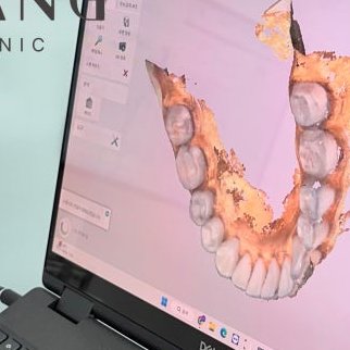 장충동임플란트 주위염 예방하고 건강하게 관련 이미지 8