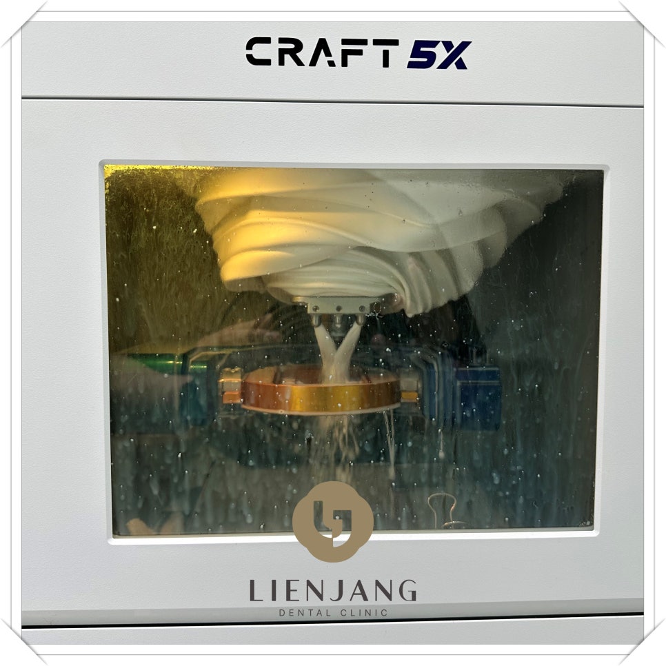 용산동임플란트 나에게 맞는 과정으로 관련 이미지 3