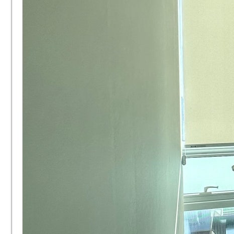 역삼임플란트 식립 과정까지 고려해야 관련 이미지 7