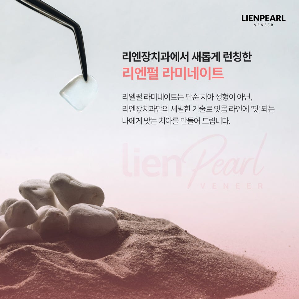 라미네이트 수명, 오래 유지하려면 무엇이 중요할까요? 관련 이미지 4