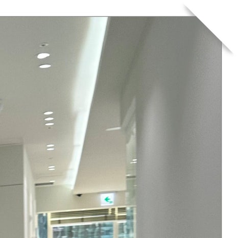 용답동임플란트 뼈 이식까지 고려한다면 관련 이미지 6