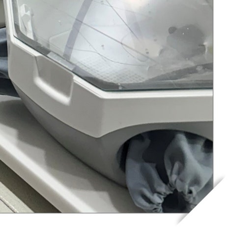 매복사랑니발치후기 읽고 걱정하셨다면 관련 이미지 11