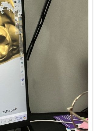 장충동임플란트 주위염 예방하고 건강하게 관련 이미지 18