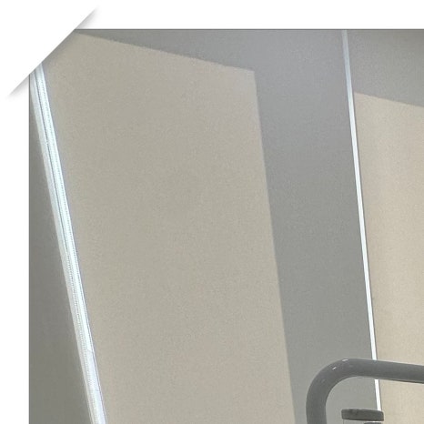 세렉인레이 하루 안에 충치 치료 마치는 방법 관련 이미지 3