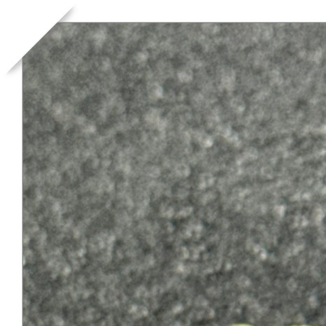 갑자기이빨아플때 원인과 치료 과정 관련 이미지 3