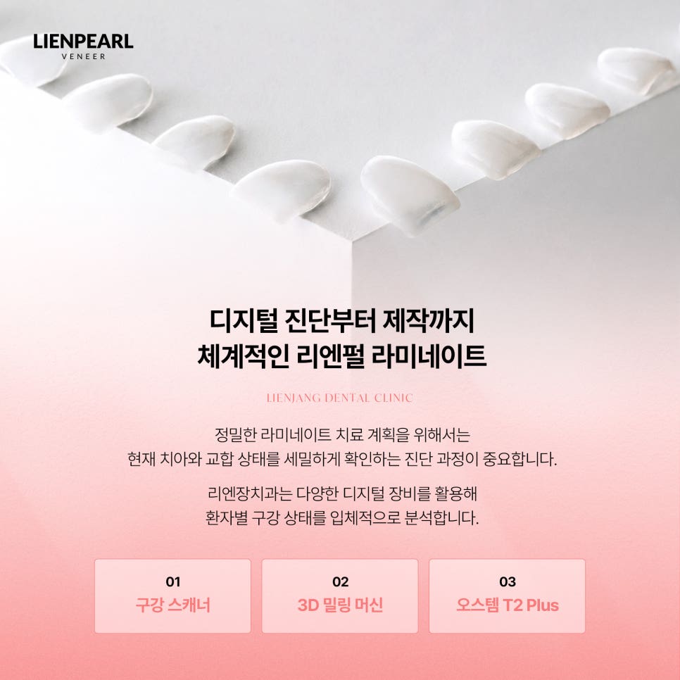 강남역 치아 라미네이트 선택 전 꼭 확인해야 할 기준 관련 이미지 6