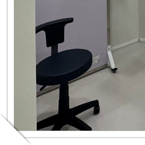 구로동라미네이트 아름다운 미소를 위한 선택 관련 이미지 28