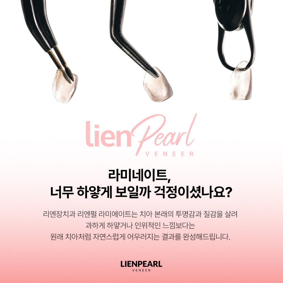 내 치아처럼 자연스럽게, 강남 라미네이트 치과 리엔펄! 관련 이미지 2