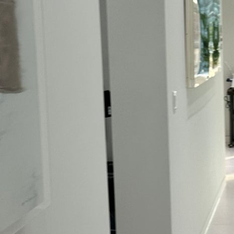 용답동임플란트 뼈 이식까지 고려한다면 관련 이미지 8