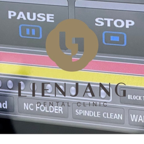 치아인플란트가격 합리적인 비교 방법 관련 이미지 10