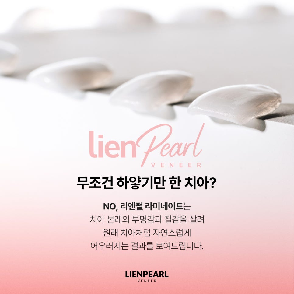 라미네이트 종류부터 맞춤 디자인까지, 나에게 어울리는 선택 방법 관련 이미지 2