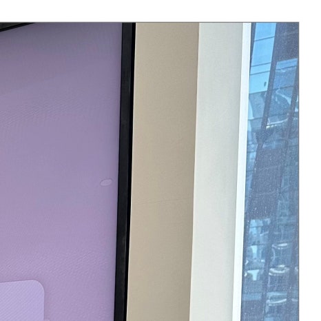 다산동임플란트 비용 부담 줄이려면 관련 이미지 6