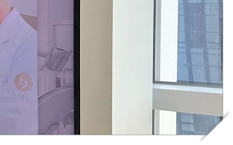 청파동임플란트 선택 고민된다면 관련 이미지 12