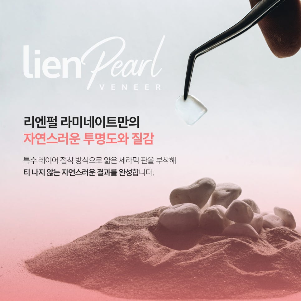 라미네이트 후기, 시술 방법과 결과! 관련 이미지 3
