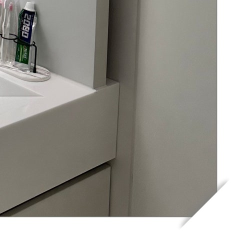 왕십리동임플란트 정밀 검진과 뼈 이식 관련 이미지 12