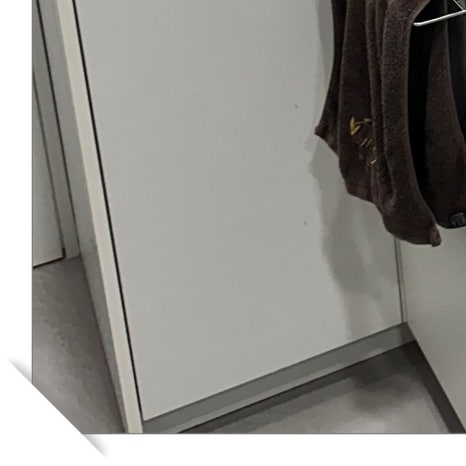 매복사랑니발치후기 읽고 걱정하셨다면 관련 이미지 9