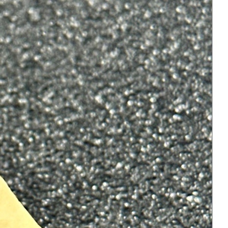 윗니 부분 교정 장단점 정리 관련 이미지 8