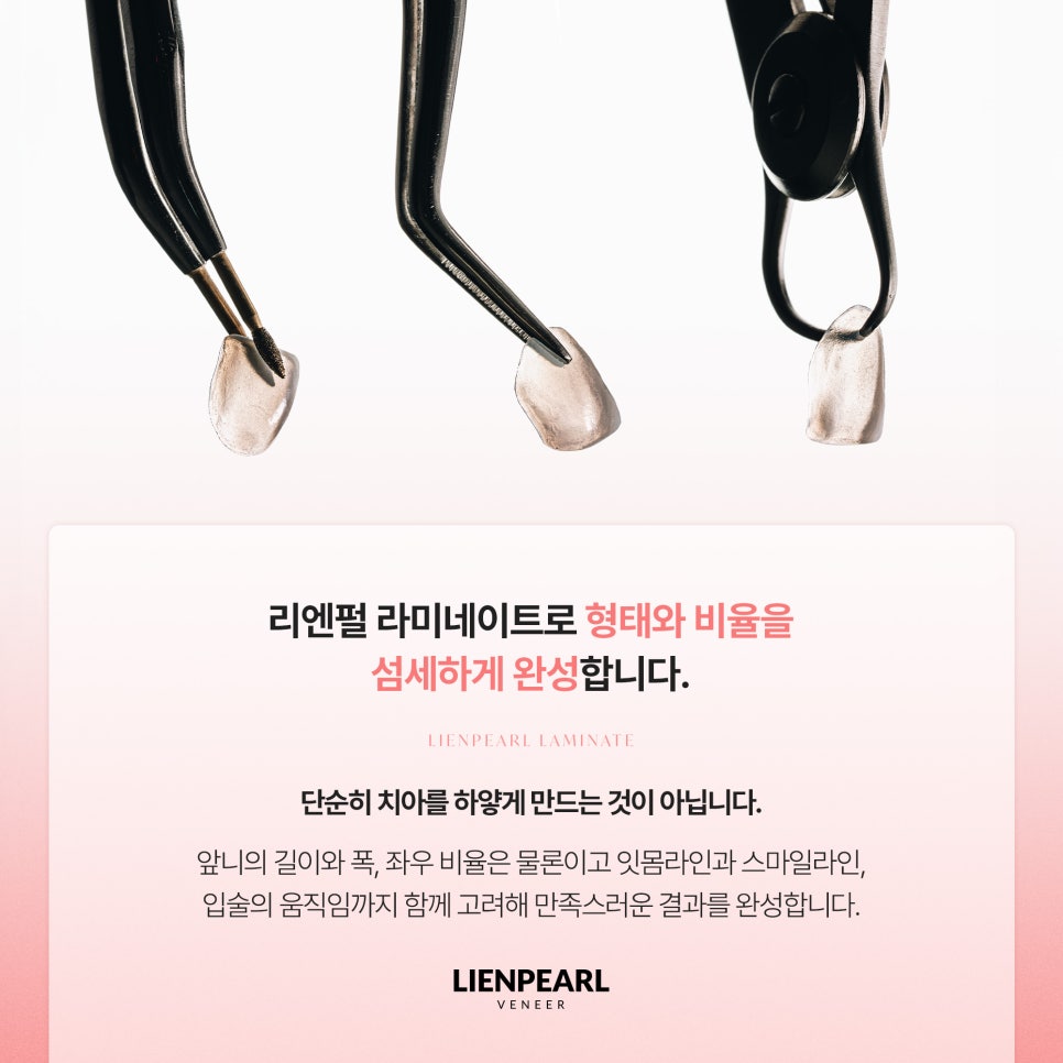 덧니 라미네이트 부담을 덜기 위한 첫 단계, 리엔패스 관련 이미지 4