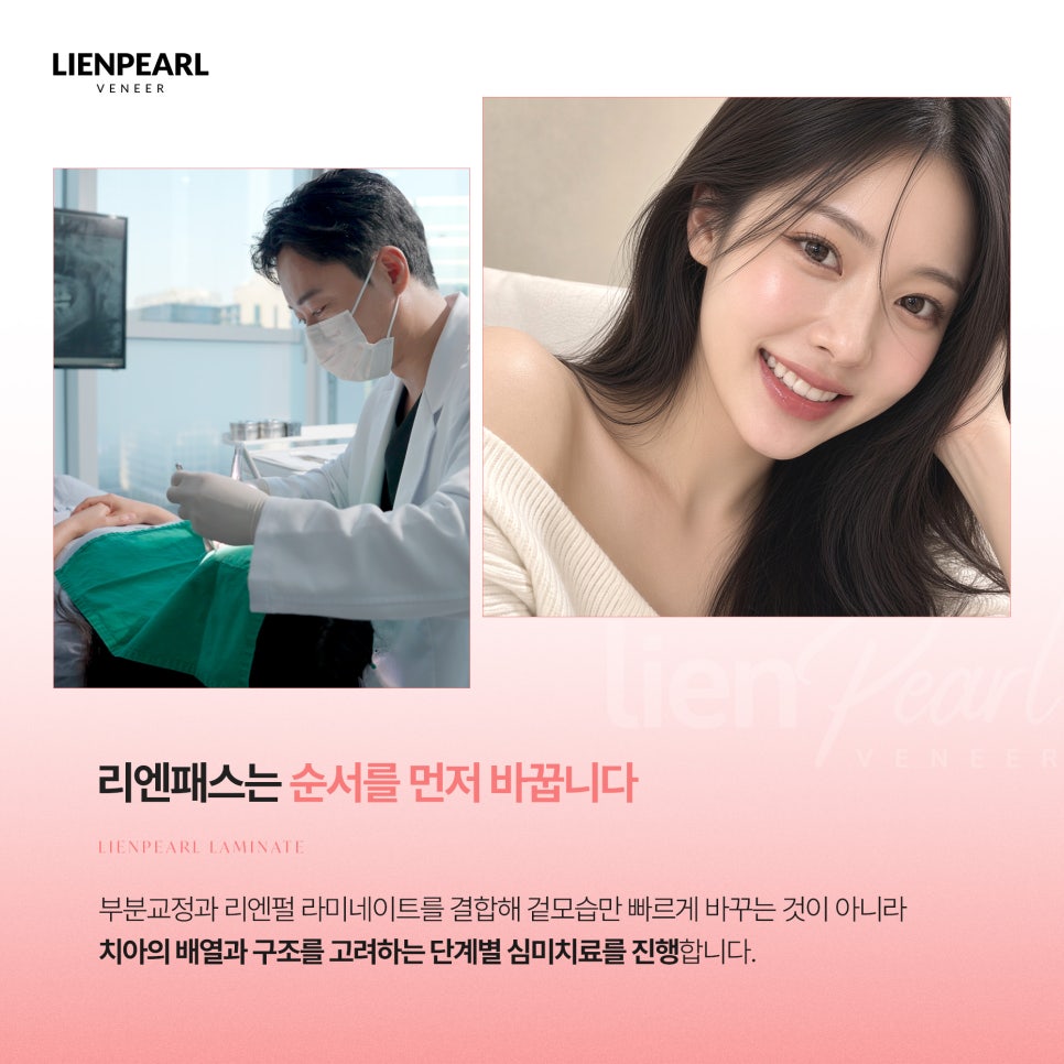 앞니 배열이 고민이라면? 치아교정 라미네이트 리엔패스! 관련 이미지 3