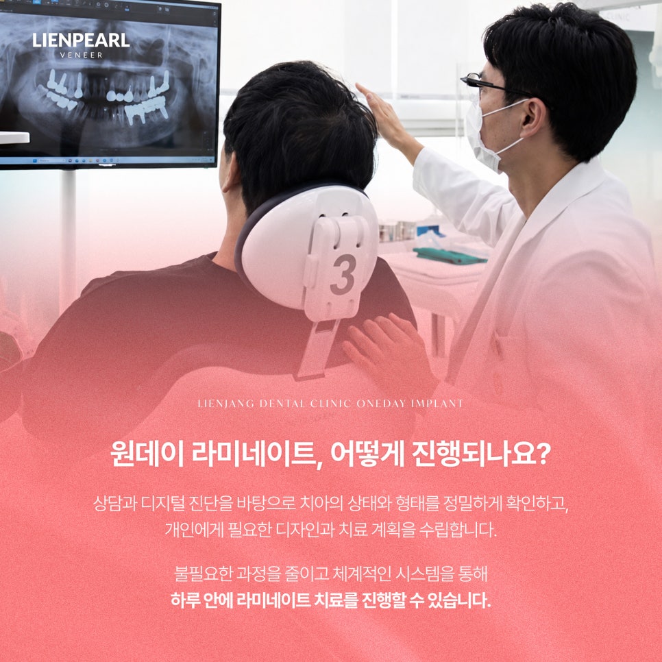 원데이 치아 라미네이트, 나에게 어울리는 자연스러움을 찾는 방법 관련 이미지 4