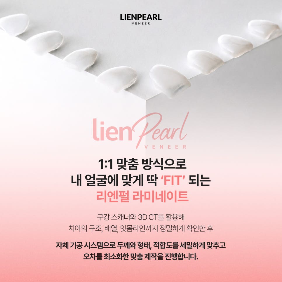 라미네이트 종류부터 맞춤 디자인까지, 나에게 어울리는 선택 방법 관련 이미지 7