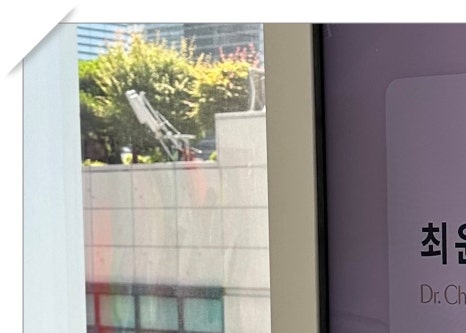 효창동임플란트 뼈 이식까지 생각한다면 관련 이미지 4