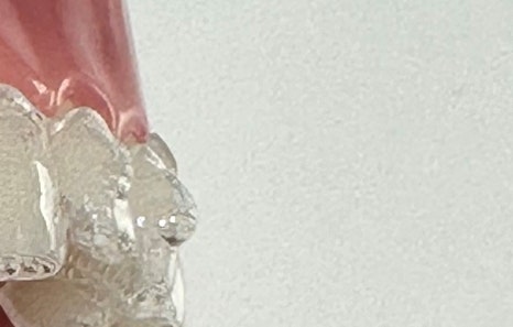 연희임플란트 디지털 네비게이션과 3D 기술로 안전하고 정밀하게 관련 이미지 14