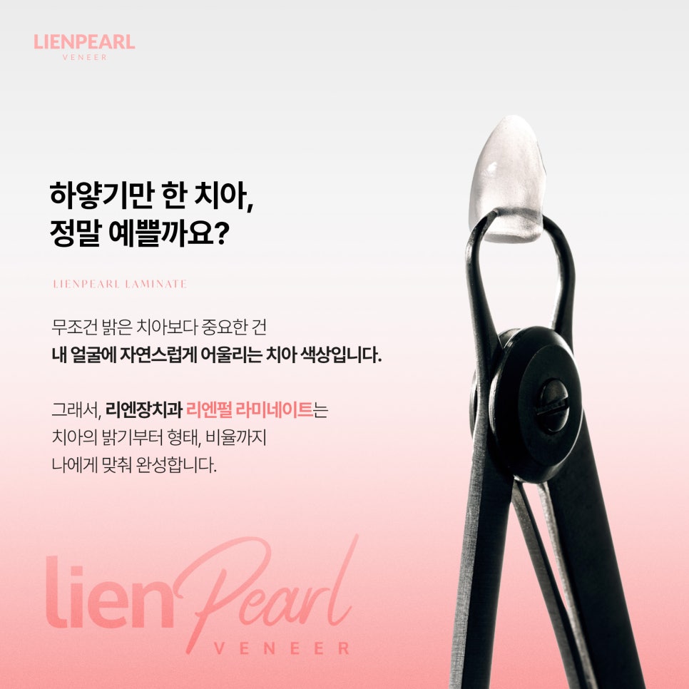 라미네이트 치아 미백, 내 얼굴에 어울리는 밝기를 찾는 법! 관련 이미지 2