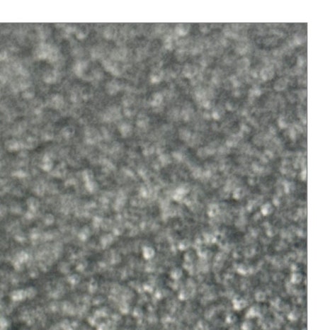 갑자기이빨아플때 원인과 치료 과정 관련 이미지 5