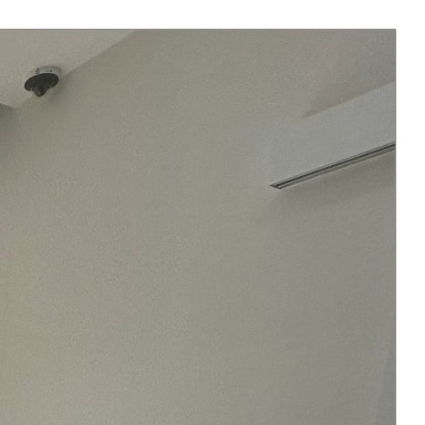 세렉인레이 하루 안에 충치 치료 마치는 방법 관련 이미지 5